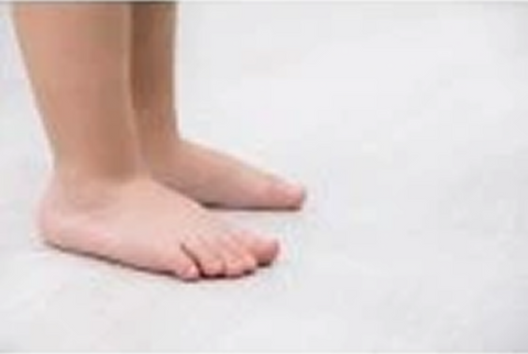Flat feet